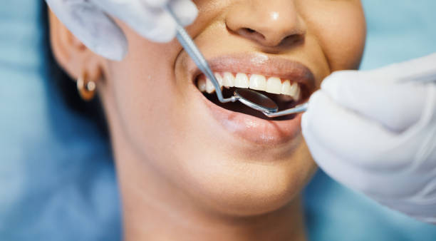 Best Emergency Treatment for Dental Infections or Abscesses in Pocono Woodland Lakes, PA
